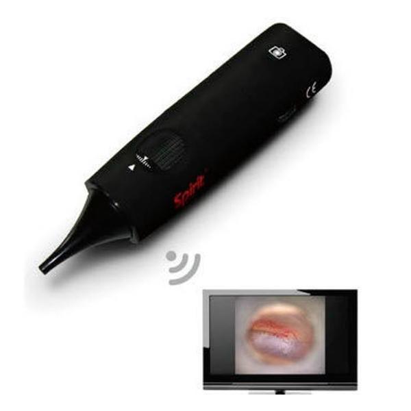 OTOSCOPE VIDEO WIRELESS W/ SOFTWARE SPIRIT